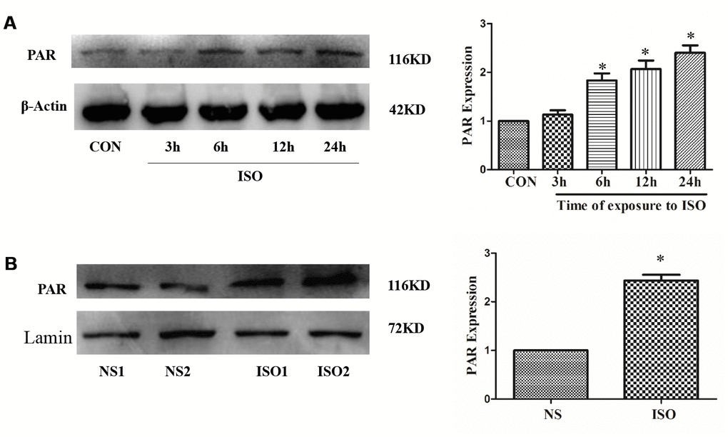 ISO upregulates PARP-1 activity. H9c2 cells were treated with 10 μM ISO for 3-24 h and SD rats were subjected to subcutaneous injections of 1.5 mg/kg/d isoproterenol for 7 d. The H9c2 cells protein (A) and SD rats’ heart tissues protein (B) were extracted after the above treatment. Western blot was used to detect PARP-1 activity. Data were presented as means±SE. *Pn=4 independent experiments.