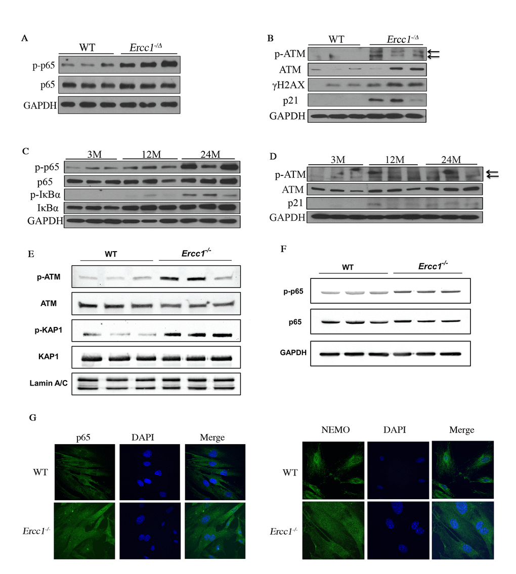 DDR and NF-κB are activated concomitantly in senescent MEFs and aged tissues. (A) Immunoblot detection of p-p65 and total p65 in liver tissue from 16-week-old WT (n=3) and Ercc1-/Δ (n=3) mice. (B) Immunoblot detection of phosphorylation of ATM and downstream targets γH2AX and p21 in liver from 16-week-old WT and Ercc1-/Δ mice. (C) Immunoblot detection of phosphorylation of NF-κB and IκBα in liver lysates from 3, 12 and 24 month-old WT mice. n=3 mice per group. (D) Immunoblot detection of p-ATM, ATM and p21 in the same liver lysates. (E) Immunoblot detection of DDR effectors in nuclear extracts from passage 5 WT and Ercc1-/- MEFs, grown at 20% oxygen. (F) Level of NF-κB activation is higher in Ercc1-/- MEFs compared to WT MEFs at passage 5, as measured by Immunoblot detection of p-p65 and total p65 in WT and Ercc1-/- MEFs at passage 5 after culturing in 20% oxygen. (G) Representative images of immunofluorescent detection of p65 and NEMO in passage 4 WT and Ercc1-/- MEFs grown at 20% oxygen. Blue: DAPI staining; Green: p65 (top panel) or NEMO (bottom panel). Images were taken at the magnification of 60x.