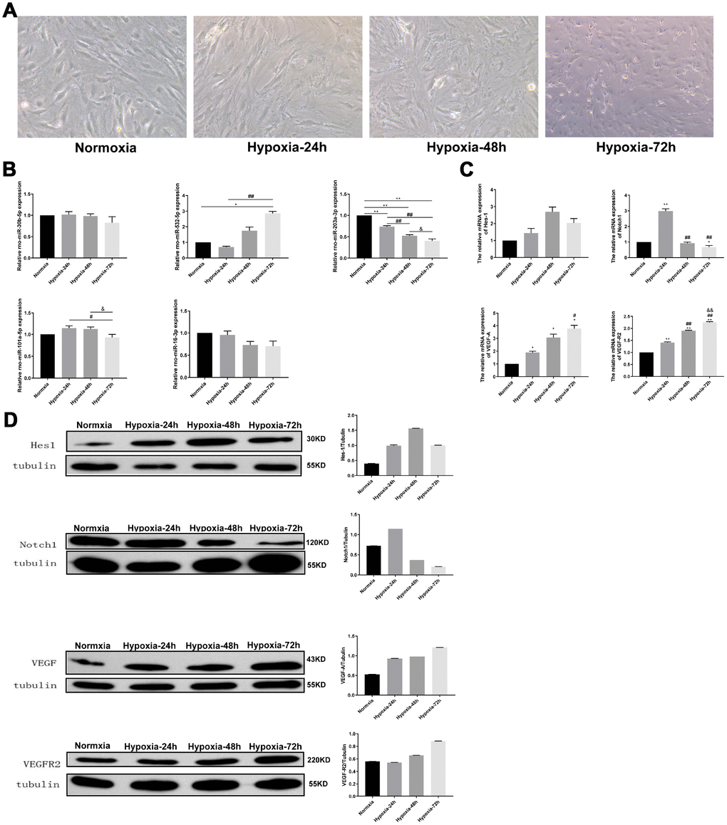 Analysis of hypoxia-induced changes in VEGF/Notch signaling effector molecules and related miRNAs in PMVECs. (A) PMVECs were cultured under hypoxia for 0, 24, 48, or 72 h. With prolongation of hypoxic exposure the cells lost their original morphology and cell population density decreased (200X). (B) Relative expression of miR-30b-5p, miR-532-5p, miR-203a-3p, miR-101a-5p, and miR-16-3p assessed by qRT-PCR. (C) Relative expression of Hes-1, Notch1, VEGF-A, and VEGFR2 mRNA measured by qRT-PCR. (D) Hes-1, Notch1, VEGF-A, and VEGFR2 expression assessed by western blotting. Data are mean ± SEM. *P **P #P ##P &P &&P 