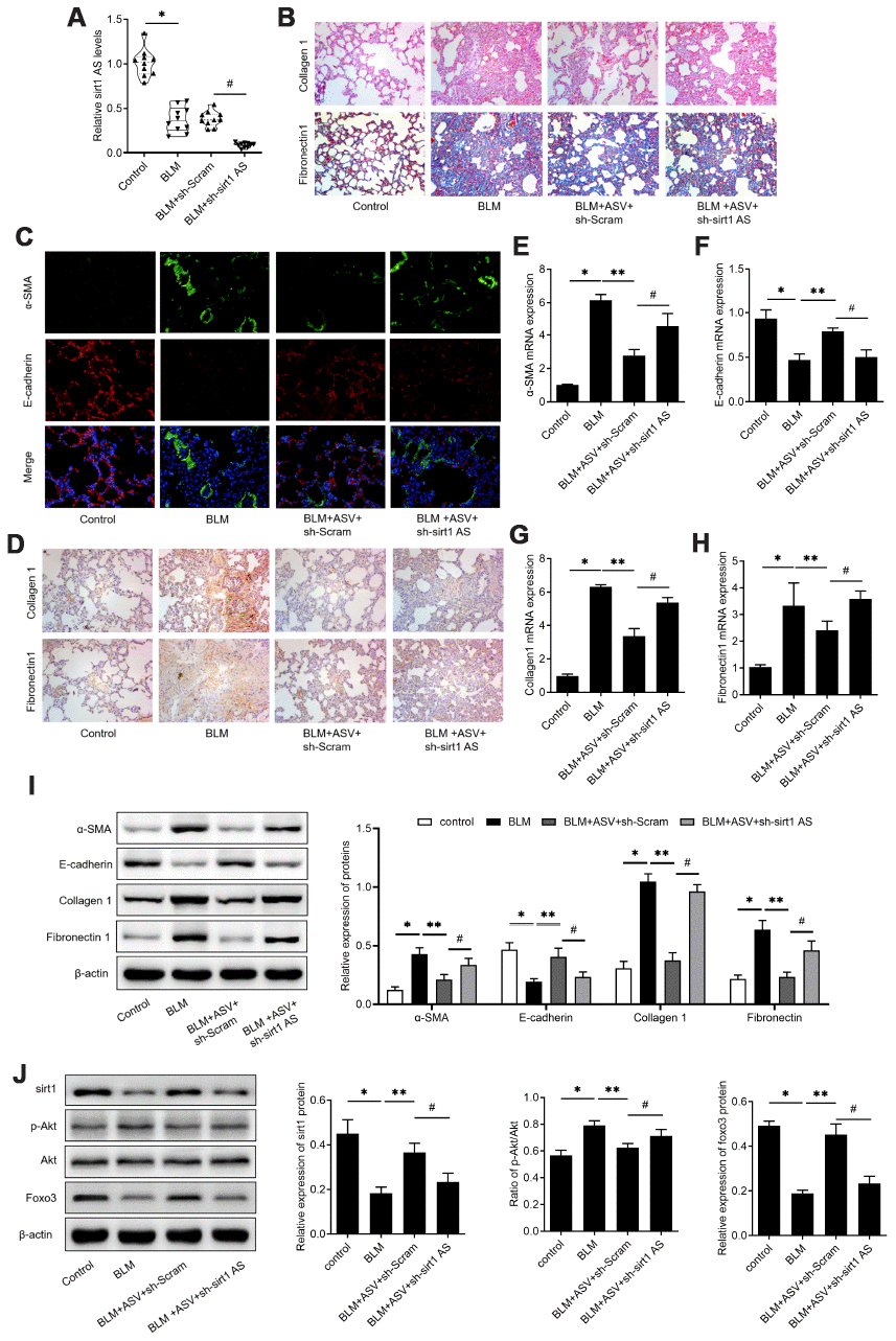 Astragaloside IV (ASV) alleviates IPF through regulating sirt1 AS/sirt1/ foxo3 axis. (A) Sirt1 AS expression in the pulmonary tissues from control mice, mice treated with bleomycin (BLM), BLM+ adenovirus shRNA against sirt1 AS (ad-sh-sirt1 AS) or BLM+ adenovirus negative shRNA (n=10 per group). (B) H&E and Masson’s trichrome staining showed pulmonary injury and collagen deposition of pulmonary tissues in mice treated with bleomycin (BLM), BLM+ adenovirus shRNA against sirt1 AS (ad-sh-sirt1 AS) or BLM+ adenovirus negative shRNA. (C) Immunofluorescence staining showing the overlap of E-cadherin (red) and a-SMA (green) in pulmonary tissues from indicated groups. (D) Immunohistochemistry analysis indicated the expression of levels of collagen 1 and fibronectin 1 in pulmonary tissues from indicated groups. (E–H) QPCR analysis demonstrated the relative expression of epithelial-mesenchymal transition (EMT)-related markers, α-SMA, E-cadherin, Collagen 1 and Fibronectin1 mRNA in indicated groups (n=10 per group). (I) Western blot assay and quantitative analyses of EMT-related markers, α-SMA, E-cadherin, Collagen 1 and Fibronectin1 protein in indicated groups (n=10 per group). (J) Western blot assay and quantitative analyses of sirt1, phosphorylated Akt, Akt and Foxo3 proteins in pulmonary tissues from indicated groups. * P