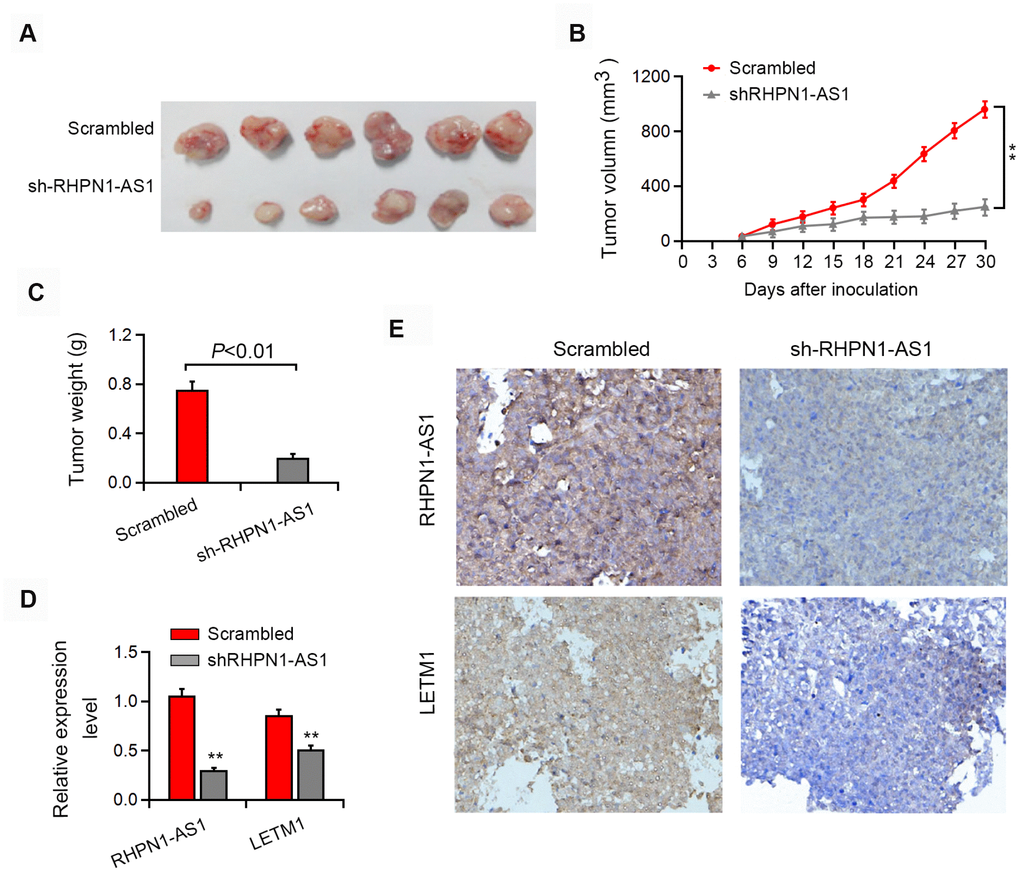 RHPN1-AS1 enhances EOC tumorigenesis in vivo. (A–C) Representative images of the formed tumor, tumor volume and tumor weight. (D–E) qRT-PCR, in situ hybridization and immunohistochemistry were used to detect the expression of RHPN1-AS1 and LETM1. *P