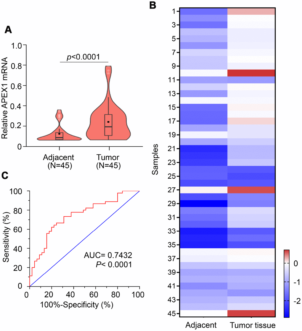APEX1 is a potential diagnostic biomarker for HCC. (A) The violin plot, (B) heatmap and (C) ROC curve analysis shows APEX1 mRNA levels in tumor and adjacent normal liver tissues isolated from 45 HCC patients.