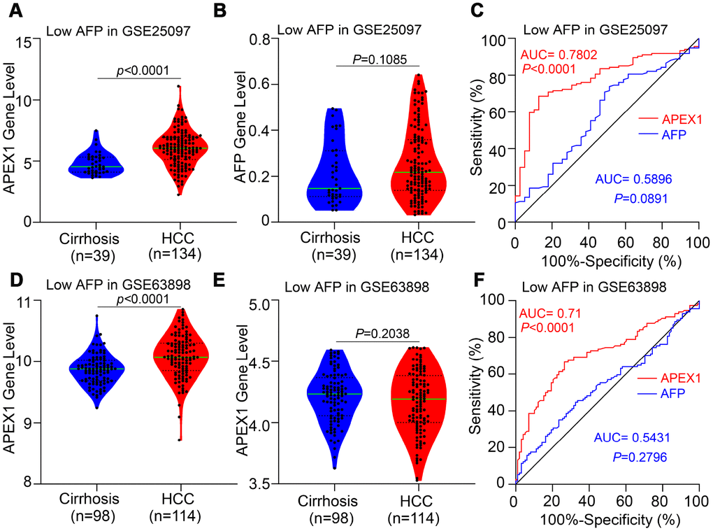 APEX1 expression is significantly higher in the HCC patients with low AFP expression and is a better diagnostic biomarker. (A, B) APEX1 and AFP mRNA expression in the liver cirrhosis (n=40) and HCC patients with low AFP expression (n=134) from the GSE25097 dataset is shown. The 134 HCC patients with low AFP expression were selected based on the median expression of AFP in 268 HCC patients from the GSE25097 dataset. (C) ROC curve analysis shows the diagnostic values of APEX1 and AFP in 134 HCC patients with low AFP expression from the GSE25097 dataset. (D, E) APEX1 and AFP mRNA expression in the liver cirrhosis (n=168) and HCC patients with low AFP expression (n=114) from the GSE63898 dataset is shown. The 114 HCC patients with low AFP expression were selected based on the median expression of AFP in 228 HCC patients in the GSE63898 dataset. (F) ROC curve analysis shows the diagnostic value of APEX1 and AFP in 114 HCC patients with low AFP expression from the GSE63898 dataset.