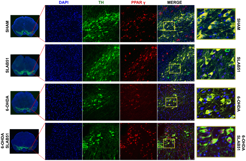 Immunofluorescence analysis for PPARγ in substantia nigra. On the left, the mosaic images obtained using confocal microscopy at 20x magnification were shown. In the center, double immunostaining at 40x magnification with TH and PPARγ as well as the merge figures were reported. On the right it is possible to observe the inset of the indicated boxes.