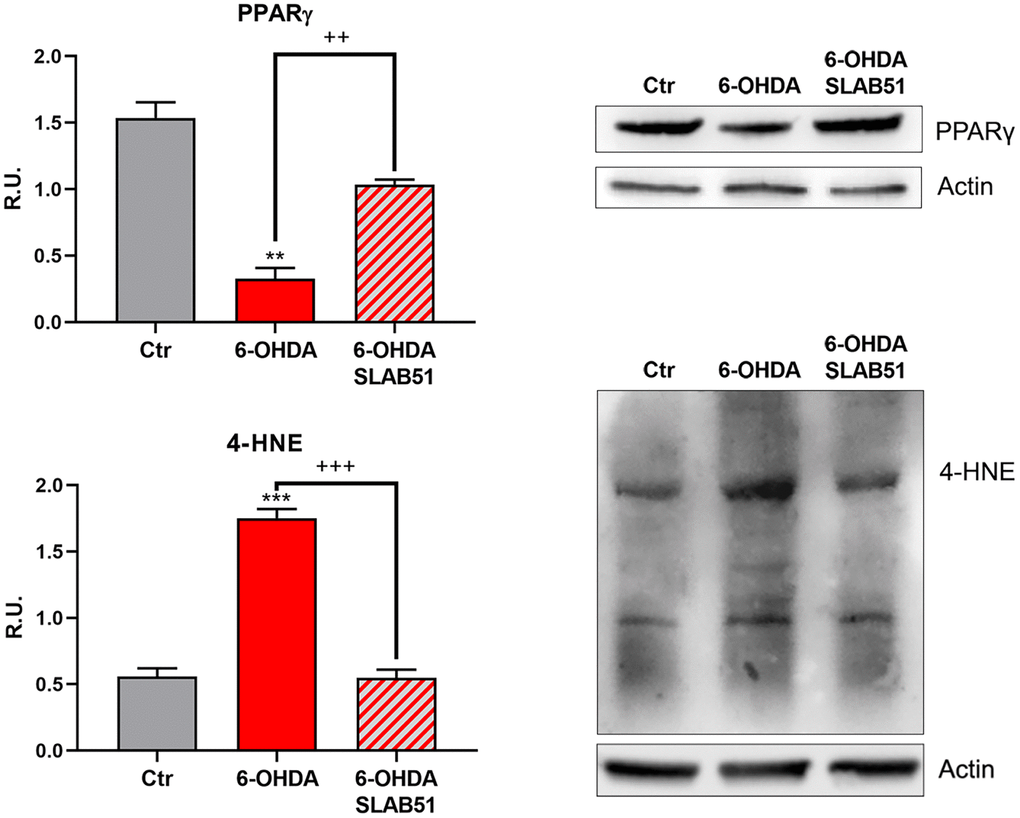 WB and relative densitometric analysis for Ctr, 6-OHDA and 6-OHDA+SLAB51 for PPARγ and 4-HNE proteins adducts. Results are mean ± SE of 3 different experiments (n=3). ** p