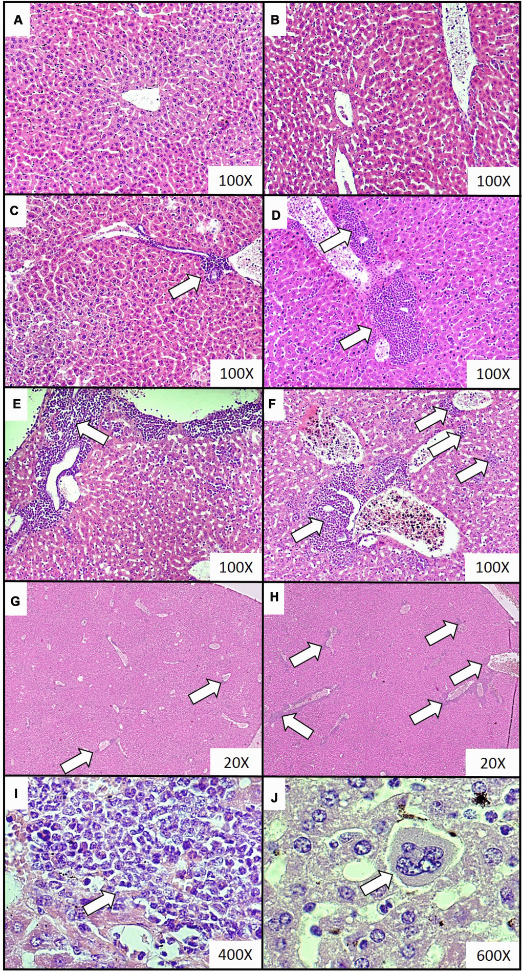 Representative histological images of the extramedullary hematopoiesis foci in livers of mice injected with 4T1 cancer cells. Extramedullary hematopoiesis was diagnosed histologically at increasing time intervals; observations were made based on slides from livers isolated during necropsy in animals injected with saline (control) (A) or after 0 (B), 2 (C), 3 (D), 4 (E) and 5 (F) weeks since the injection of 4T1-cancer cells. Hematoxylin and eosin staining, magnification of 100X. Additional images under lower optical magnification (20x) present extramedullary hematopoiesis foci in samples of lungs resected from mice at the second (G) and fifth (H) week of breast cancer development. The representative foci under higher magnification show the progenitor hematopoietic cells next to mature granulocytes (I) (400x) and a megakaryocyte (J) (600x). Extramedullary hematopoiesis foci are marked with white arrows. More experimental details are given in the Materials and methods section.