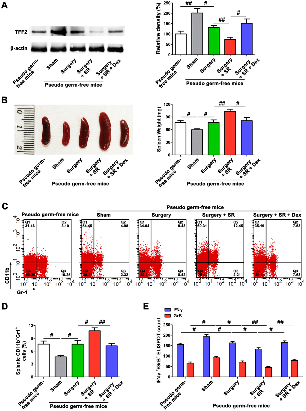 Dexmedetomidine (Dex) attenuated postoperative sleep-restriction (SR)-induced decrease in splenic trefoil factor 2 (TFF2) expression, increase in myeloid-derived suppressor cells (MDSCs) expansion and decrease in splenic CD8+ cells activity via improving gut microbiota disturbance. (A) Western blotting analysis of splenic TFF2 expression in sham-operated mice and pseudo-germ-free mouse received fecal microbiota transplantation (FMT). (B) Spleen weight in sham-operated mice and pseudo-germ-free mouse received FMT. (C, D) Flow cytometry analysis of spleen for CD11b+ Gr-1+ MDSCs in sham-operated mice and pseudo-germ-free mouse received FMT. (E) The enzyme-linked immunospot (ELISPOT) assay of the levels of interferon-γ (IFN-γ) and Granzyme B (GrB) in splenic CD8+ T cells from sham-operated mice and pseudo-germ-free mouse received FMT. All data represent mean ± SEM, n = 5; #P ##P 