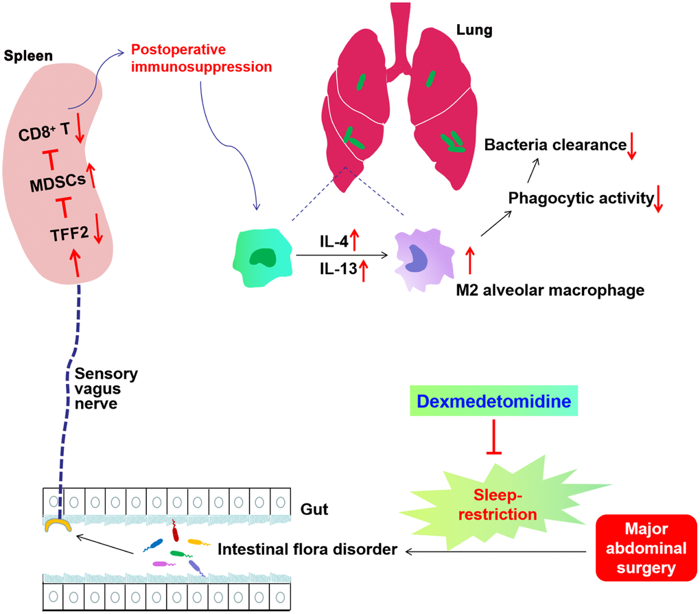 Schematics illustrating the signaling mechanisms of sleep-restriction in postoperative immunosuppression and its treatment by dexmedetomidine. Sleep-restriction exaggerates intestinal flora disorder, furtherly decreases splenic trefoil factor 2 (TFF2) expression, which subsequently leads to the increase in myeloid-derived suppressor cells (MDSCs) numbers and decrease in splenic CD8+ T cells activity. Subdiaphragmatic vagus nerve (SVN) served as an important conduit of gut microbiota-spleen communication. SR-induced exaggeration of postoperative immunosuppression was characterized by increased expression of IL-4 and IL-13 in the lung, increased M2 polarization of alveolar macrophages (AMs), decreased phagocytic activity of AMs and thus decreased antimicrobial activity in E. coli pneumonia. Dexmedetomidine treatment during SR alleviated SR-induced decrease in postoperative immunosuppression through gut microbiota and SVN.