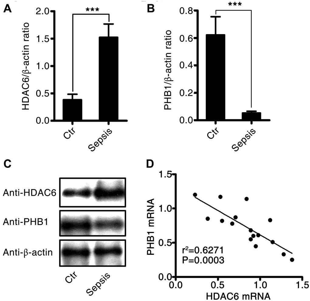 Expression and correlation of HDAC6 and PHB1 in sepsis patients. Human PBMCs were isolated from healthy control participants and patients with sepsis. HDAC6 and PHB1 mRNA and protein levels were measured by qPCR and western blotting, respectively. The linear correlation between HDAC6 and PHB1 expression was analyzed using the GraphPad Prism software. (A) HDAC6 mRNA; (B) PHB1 mRNA; (C) HDAC6 and PHB1 protein expression; (D) the correlation between HDAC6 and PHB1 expression. Results are expressed as the mean ± SEM. *P 