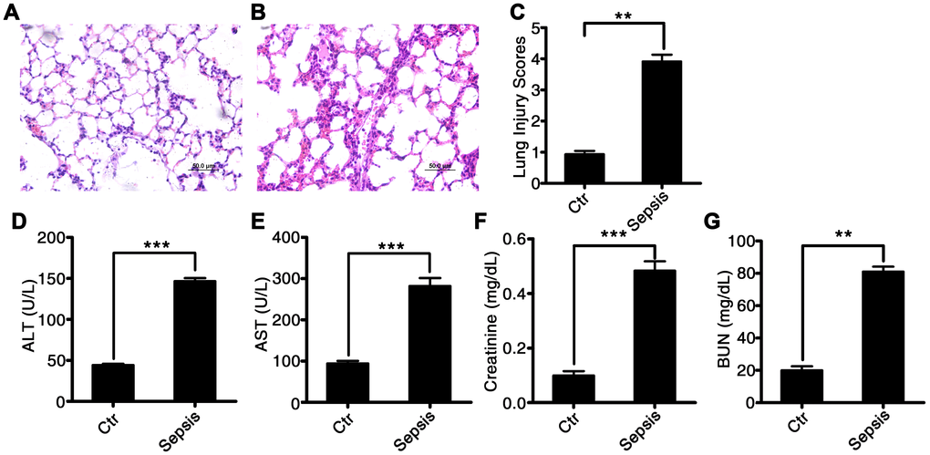 Characterization of CLP-induced sepsis in rats. Serum and tissue samples from rats with untreated CLP-induced sepsis, rats with Tri A–treated CLP sepsis, or healthy control rats. (A) Lung tissue from the control group of rats; (B) lung tissue from rats with CLP-induced sepsis; (C) lung injury index; (D) ALT activity; (E) AST activity; (F) creatinine concentration; and (G) BUN levels in the plasma from healthy control rats and CLP-induced sepsis rats. Results are expressed as the mean ± SEM. *P 