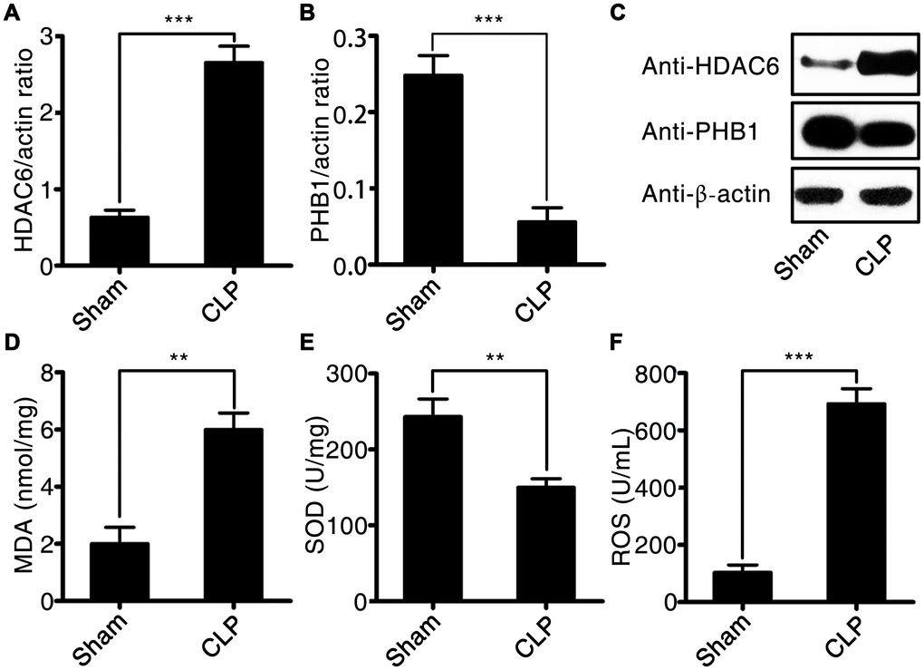 HDAC6 and PHB1 expression and oxidative stress in rats with CLP-induced sepsis. (A) HDAC6 mRNA expression; (B) PHB1 mRNA expression; (C) HDAC6 and PHB1 protein expression; (D) MDA levels; (E) SOD activity; and (F) ROS production in CLP-induced sepsis rats and healthy control rats. Results are expressed as the mean ± SEM. *P 