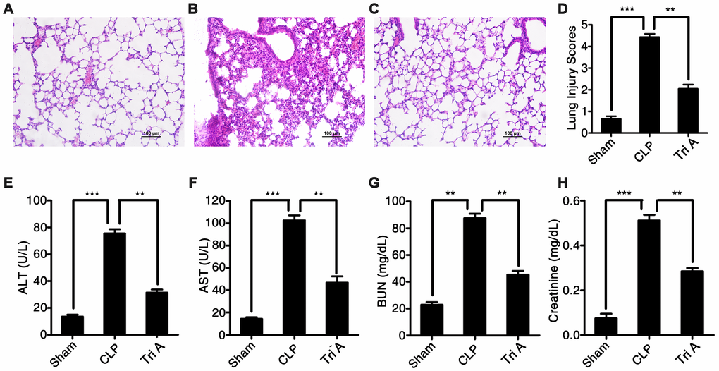 The impact of HDAC6 inhibition on CLP-induced sepsis. Hematoxylin and eosin (H&E)-stained lung tissue sections from rats with CLP-induced sepsis, rats with CLP-induced sepsis treated with Tri A, or control rats (×200 magnification). (A) Lung tissue from control rats; (B) lung tissue from rats with CLP-induced sepsis; (C) lung tissue from rats with CLP-induced sepsis treated with Tri A; (D) the lung injury index of differentially treated rats; (E) ALT activity; (F) AST activity; (G) creatinine concentration; and (H) BUN levels in the plasma from the rats with CLP-induced sepsis, the rats with CLP-induced sepsis treated with Tri A, or the control rats. Results are expressed as the mean ± SEM. *P 