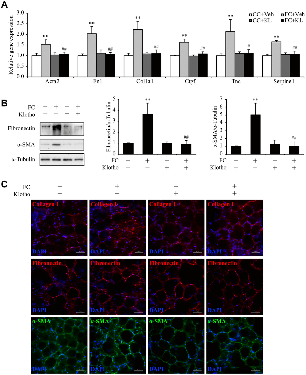 Kl markedly ameliorates pulmonary fibrosis in an ex vivo model. Mouse PCLSs that were pre-incubated with vehicle (Vel) or mouse rKL for 24 h were randomized to be treated with control cocktail (CC) or fibrosis cocktail (FC) with or without KL for another 48 h. mRNA levels of Acta2, Fn1, Col1a1, Ctgf, Tnc, and Serpine1 were assessed by qPCR (A), protein levels of fibronectin and α-SMA were measured by western blotting (B), and fibronectin, α-SMA, and collagen I were stained by immunofluorescence staining (C) in the mouse PCLSs from each group (CC+Veh, white bars; FC+Veh, light gray bars; CC+rKL, dark gray bars; FC+rKL, black bars). Scale bars = 50 μm. **P vs. CC+Veh. #P P vs. FC+Veh.