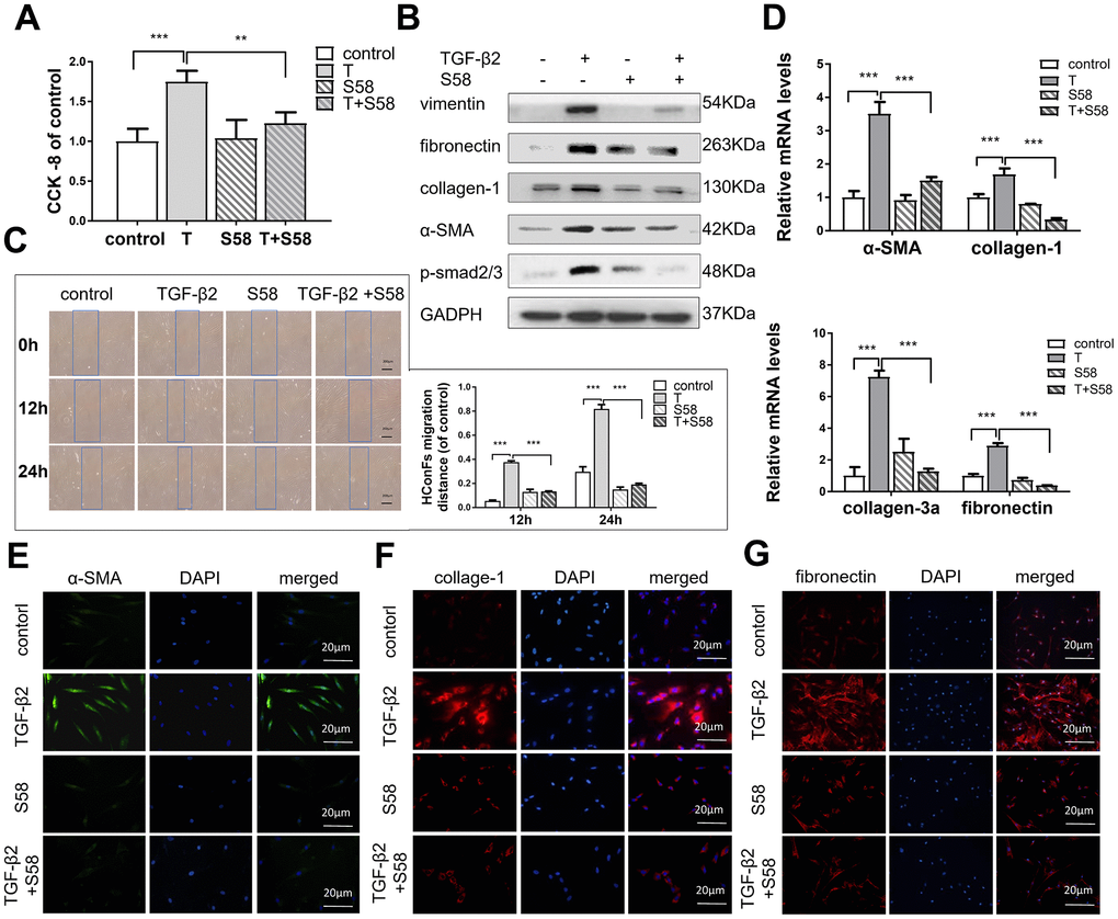 S58 reduces TGF-β2-induced HConFs fibrosis. (A) Effect of TGF-β2 and S58 on HConFs viability (B) Western blot of fibrosis-related proteins. (C) Representative images and quantification of cell motility of TGF-β2-treated HConFs with or without the presence of S58 at specified times (Dotted blue lines: edges of the migrated cells). (D) mRNA levels of fibronectin, collagen-1, α-SMA and collagen-3a. (E–G) Levels of α-SMA, fibronectin, and collagen-1 were analyzed by immunofluorescence staining after 24h treatment (Nuclei = blue, α-SMA = green, fibronectin/collagen-1 = red). Data indicate the mean ± SD. n=3. *p 