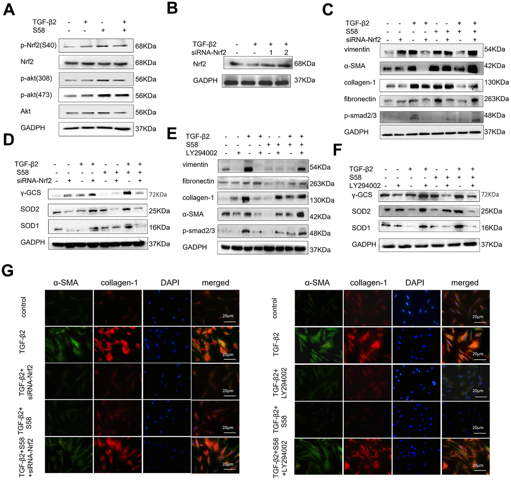 S58 promotes antioxidant defense against TGF-β2-induced fibrosis in HConFs via the activation of PI3K/Akt/Nrf2 signaling pathway. (A) p-Nrf2(S40), Nrf2, Akt, p-Akt (308) and p-Akt (473) levels in cell lysates from TGF-β2-pretreated HConFs for 24h. (B) Screening for specific siRNAs to knock down Nrf2 protein. (C, E) Relative levels of fibrotic proteins and (D, F) antioxidant defense proteins in whole cell lysates from S58-treated HConFs with/without siRNA-Nrf2 transfection(or LY294002 (40×10-6 m) after 72h. (G) Fibrosis levels were analyzed by co-staining of α-SMA and collagen-1 immunofluorescence.