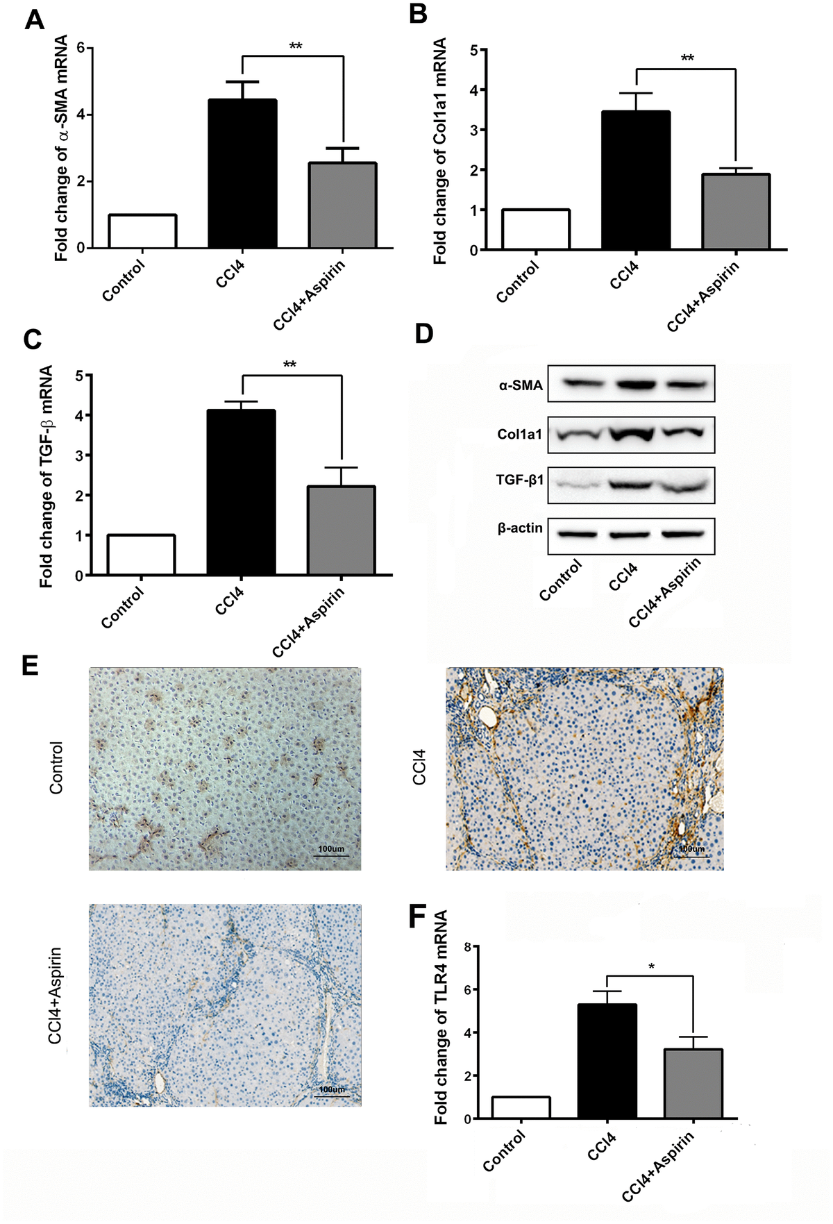 Aspirin alleviates hepatic fibrosis by suppressing hepatic stellate cells activation via the