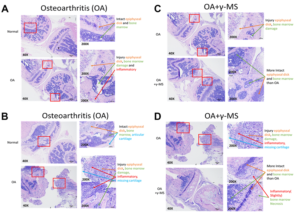 Comparative immunohistochemical analysis between the knee joints from control and γ-MS treatment groups. The representative section of OA mice demonstrated signs of cartilage degradation and tissue injuries (epiphyseal disk and bone marrow) and inflammation in comparison to healthy normal counterparts (A, B). γ-MS treated mice showed a lower degree of cartilage destruction and more intact epiphyseal disk and bone marrow. as well as less inflamed in comparison to non-treated OA control group (C, D). H & E- stained images were taken at 40X (Bar = 100μM) and 200X magnification (Bar = 50μM).