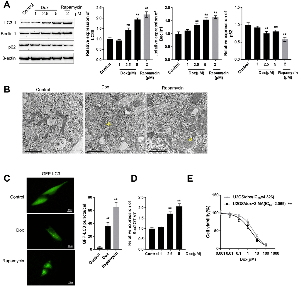Dox treatment induces autophagy and Sox2OT-V7 expression in U2OS cells. (A) U2OS cells were treated with 1, 2.5, or 5 μM Dox or 2 μM rapamycin, and the expression of LC3II, Beclin 1, and p62 was measured. U2OS cells with stable eGFP-LC3 expression were treated with Dox (5 μM) or rapamycin (2 μM) for 24 h. Autophagy was examined by transmission electron microscopy (B) puncta were imaged by using a confocal microscope, and representative images are presented (C). (D) U2OS cells were treated with 1, 2.5 or 5 μM Dox and examined for the expression of Sox2OT-V7. (E) U2OS cells were treated with 0.001, 0.01, 0.1, 1, 10, and 100 μM Dox in the presence or absence of the autophagy inhibitor 3-MA and examined for cell viability (IC50 value). The data are presented as the mean ± SD of three independent experiments. **P