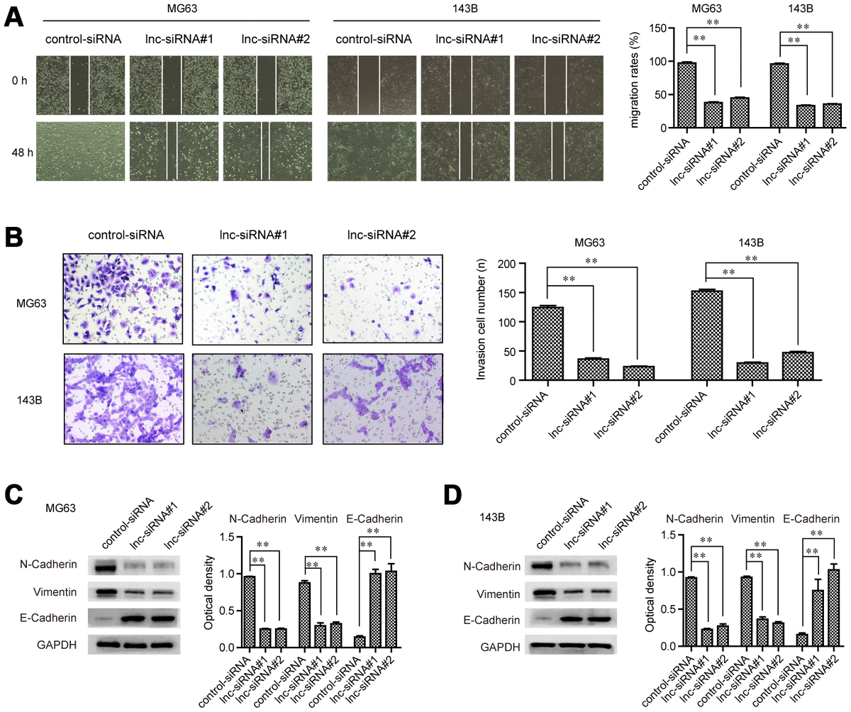 USF1-mediated upregulation of lncRNA GAS6-AS2 facilitates osteosarcoma ...