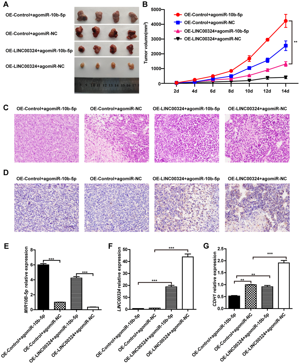 LINC00324 inhibited tumor growth in nude mice xenograft models. (A) Dissection of tumors from non-obese diabetic (NOD) mice xenografted with agomiR-10b-5p alone or combined with overexpressed-LINC00324 MDA-MB-231 cells. (B) Tumor volume curve of overexpressed-LINC00324 and agomiR-10b-5p treatment groups were measured and analyzed. (C) Hematoxylin and eosin-stained images of breast cancer tissues from NOD mice xenografted with agomiR-10b-5p alone or combined with overexpressed-LINC00324 MDA-MB-231 cells. (D) Immunohistochemical staining of E-cadherin expression in breast cancer tissues from NOD mice xenografted with agomiR-10b-5p alone or combined with overexpressed-LINC00324 MDA-MB-231 cells. (E–G) Relative expression of miR-10b-5p, LINC00324, and CDH1 in breast cancer tissues from NOD mice xenografted with agomiR-10b-5p alone or combined with overexpressed-LINC00324 MDA-MB-231 cells. All data are shown as means ± SEM. ** P P B, E–G), or are representative of three independent experiments with similar results (A, C, D).