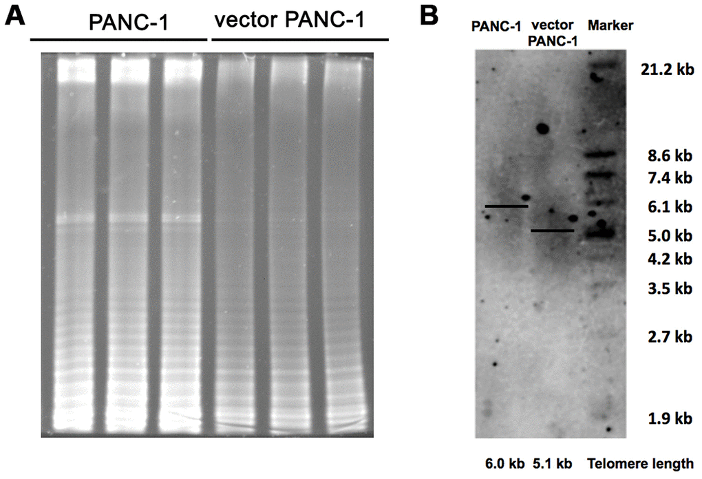 Inhibited telomere elongation in low-CPT1C-expressing senescent vector PANC-1 cells. (A) Telomerase activity was analyzed with the TRAP assay in mock and vector PANC-1 cells. This experiment was repeated three times. (B) Telomere length was determined with the TRF length assay in mock and vector PANC-1 cells.