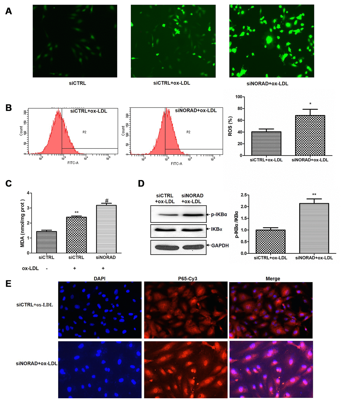 Downregulation of lncrna norad promotes ox-ldl-induced vascular