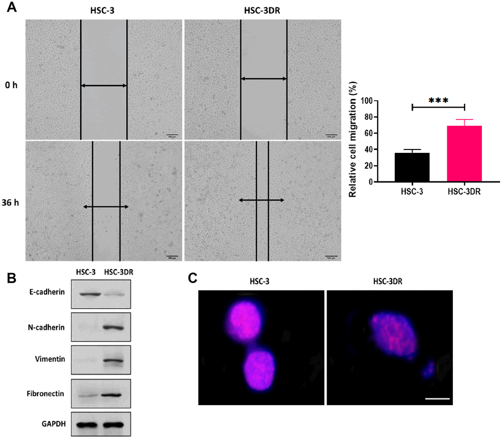 Docetaxel resistance in HSC-3 cells (HSC-3DR) was associated with EMT and elevated drug efflux. (A) Migration ability of HSC-3 and HSC-3DR cells was determined by wound healing assays (scale bars = 100 μm). (B) The expressions of EMT-associated proteins in HSC-3DR cells were determined by western blots. (C) The expression of nuclear γ-H2AX of HSC-3 and HSC-3DR cells was determined by fluorescence assays (scale bars = 10 μm). Data are presented as mean ± SD. *P P P 