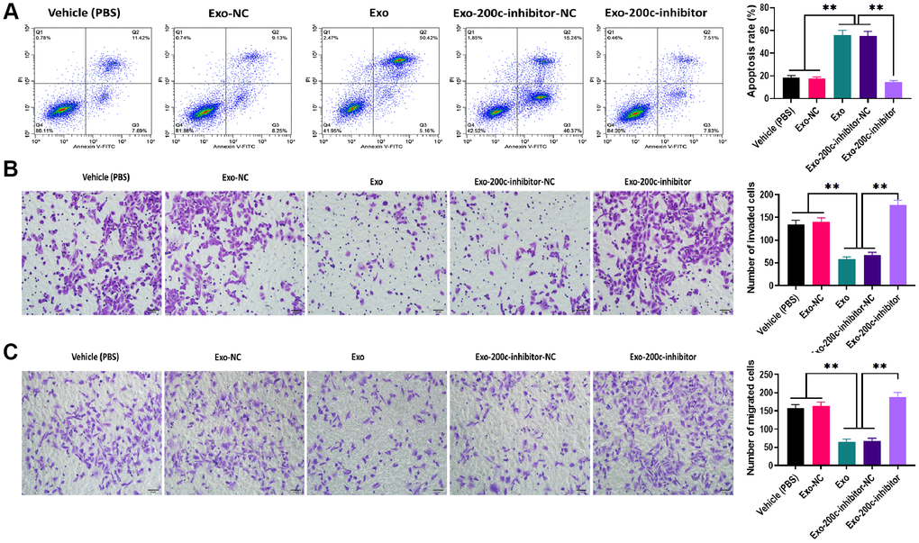 MiR-200c-carrying exosomes promoted apoptosis and inhibited migration ability in docetaxel-resistant HSC-3 (HSC-3DR) cells. (A) Apoptosis was determined by flow cytometry in HSC-3DR cells treated with miR-200c-carrying exosomes or miR-200c-carrying exosomes with the miR-200c inhibitor. (B) Invasion ability was determined by Transwell assays in HSC-3DR cells treated with miR-200c-carrying exosomes or miR-200c-carrying exosomes with the miR-200c inhibitor (scale bars = 50 μm). (C) Migration ability was determined by Transwell assays in HSC-3DR cells treated with miR-200c-carrying exosomes or miR-200c-carrying exosomes with the miR-200c inhibitor (scale bars = 50 μm). Data are presented as mean ± SD. *P P P 