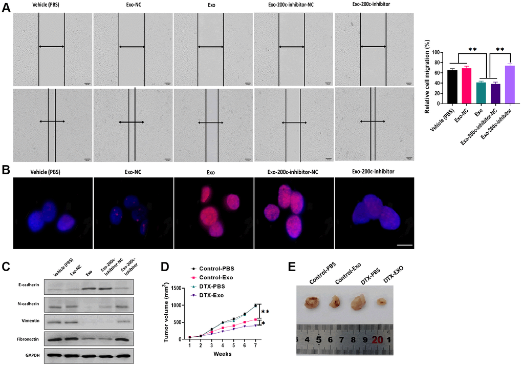 MiR-200c-carrying exosomes regulated docetaxel resistance in in vitro and in vivo. (A) Migration ability was determined by wound healing assays in HSC-3DR cells treated with miR-200c-carrying exosomes or miR-200c-carrying exosomes with the miR-200c inhibitor (scale bars = 100 μm). (B) The expression of nuclear γ-H2AX was determined by fluorescence assays in HSC-3DR cells treated with miR-200c-carrying exosomes or miR-200c-carrying exosomes with the miR-200c inhibitor (scale bars = 10 μm). (C) The expressions of EMT-associated proteins were determined by western blots in HSC-3DR cells treated with miR-200c-carrying exosomes or miR-200c-carrying exosomes with the miR-200c inhibitor. (D) Tumor volume of xenograft mice treated with miR-200c-carrying exosomes or miR-200c-carrying exosomes with the miR-200c inhibitor. (E) Representative images of tumors. Data are presented as mean ± SD. *P P P 