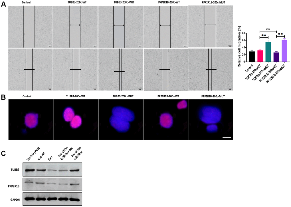 MiR-200c-carrying exosomes regulated expressions of TUBB3 and PPP2R1B. (A) Migration ability was determined by wound healing assays in HSC-3DR cells transfected with TUBB3 or PPP2R1B-carrying vectors with the wild-type or mutant miR-200c sequence (scale bars = 100 μm). (B) The expression of nuclear γ-H2AX was determined by fluorescence assays in HSC-3DR cells transfected with TUBB3 or PPP2R1B-carrying vectors with the wild-type or mutant miR-200c sequence (scale bars = 10 μm). (C) The protein expressions of TUBB3 and PPP2R1B were determined by western blots in HSC-3DR cells treated with miR-200c-carrying exosomes or miR-200c-carrying exosomes with the miR-200c inhibitor. Data are presented as mean ± SD. *P P P 