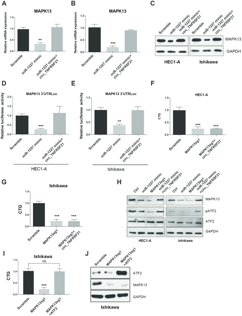 circTNFRSF21 rescues MAPK13-ATF2 signaling pathway by acting as miR-1227 sponge in EC cells. Detection of MAPK13 transcription (A, B) and protein level (C). (D, E) Luciferase assay detect MAPK13 3’UTR activity. (F, G) Cell growth detection after knocking down MAPK13 in the presence or absence or circTNFRSF21. (H) Western blot detects MAPK13, ATF2, phosphorylated ATF2 expression. GAPDH was used as internal control. (I) Cell growth detection after knocking down MAPK13 in the presence or absence or ATF2. (J) Western blot detects MAPK13, ATF2 expression, GAPDH was used as internal control. *P