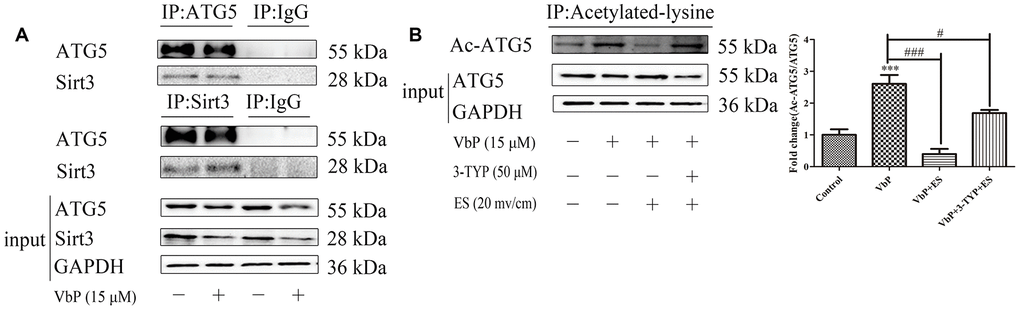 ES induces Sirt3-mediated deacetylation of ATG5 in VbP-treated macrophages. (A) Representative western blots of ATG5 expression following immunoprecipitation with an anti-Sirt3 antibody (top), Sirt3 expression following immunoprecipitation with an anti-ATG5 antibody (middle) and ATG5 and Sirt3 expression in total cell lysates (bottom). (B) Representative western blot and quantitative analysis of acetylated-ATG5 in macrophages treated with VbP, 3-TYP, and ES. n =3; ***P#P###P