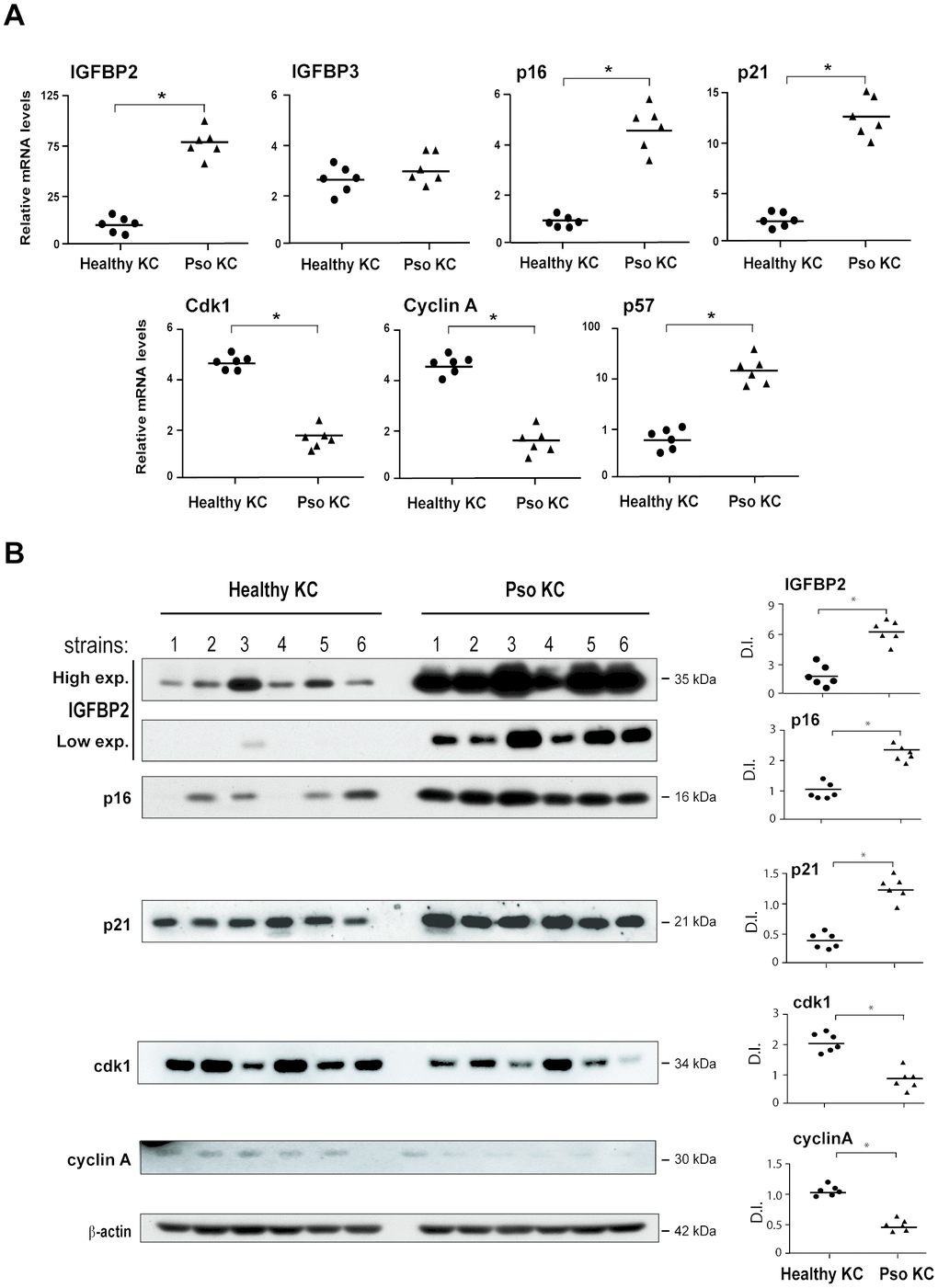 Psoriatic keratinocyte cultures display enhanced IGFBP2 expression, together with an altered expression of genes implicated in the regulation and cell cycle arrest. (A) Real-time PCR analysis was performed on keratinocyte cultures (at passage P4), obtained from lesional skin of psoriatic patients (n = 6) (pso KC) and healthy volunteers (n = 6) (healthy KC). Results are shown as individual values of relative mRNA levels (normalized to β-actin) of IGFBP2, IGFBP3, p16, p21 Cdk1, cyclin A and p57 and means of the two different groups. (B) WB analysis was performed on protein lysates from keratinocyte cultures isolated from healthy (n = 6) and lesional skin (n = 6) by using anti-IGFBP2, cyclin A, cdk1, -p16 and -p21 Abs. β-actin was used as loading control. Bands relative to IGFBP2 were showed at two different exposure times (High exp. 1 min; low exp., 30 seconds). Graphs represent the individual values and the means of the densitometric intensity (D.I.) of each band. (A, B), *p ≤ 0.05, as calculated by the Mann–Whitney U test.