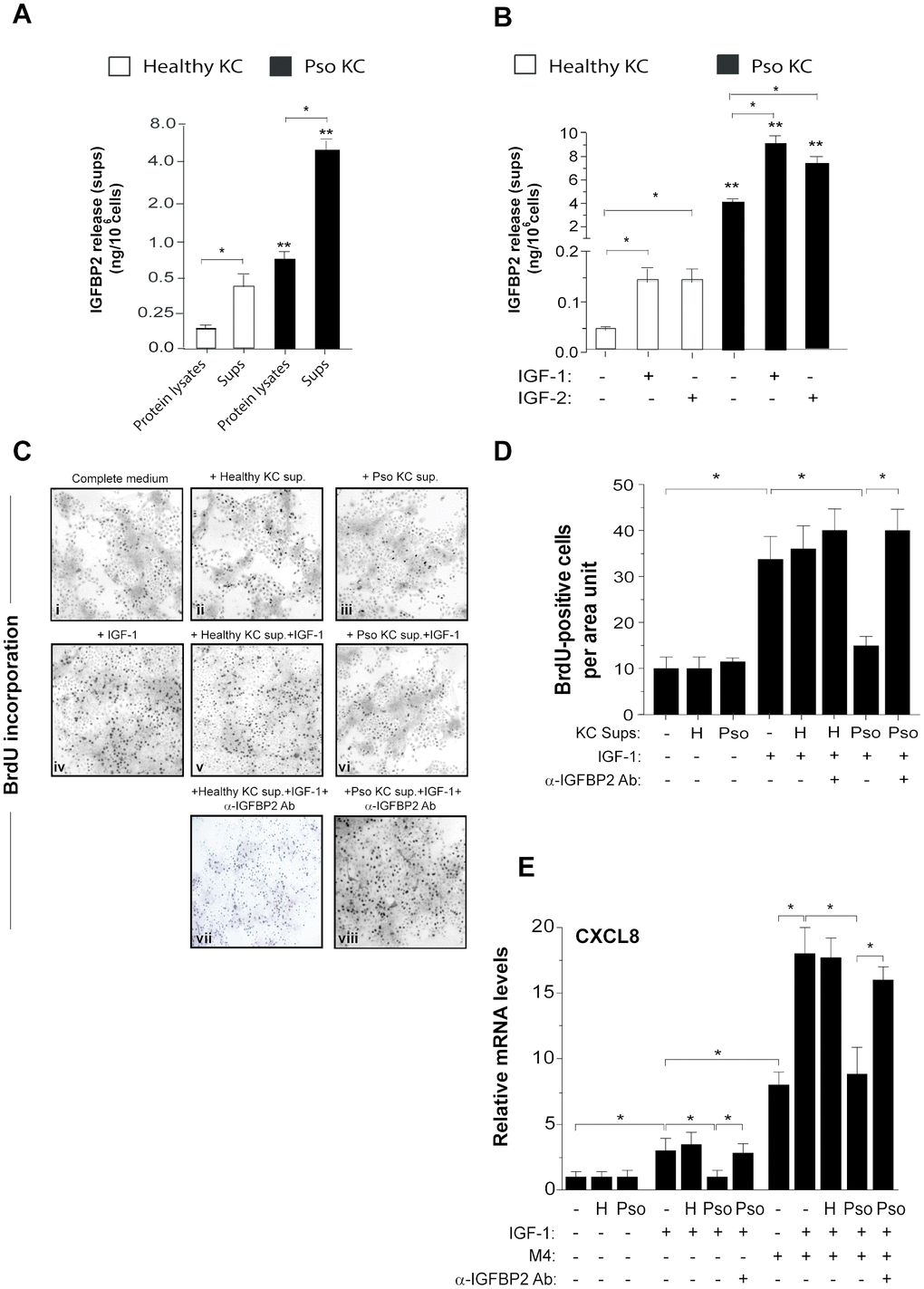 IGFBP2 production is induced by IGF-1 and is functionally active in psoriatic keratinocytes. IGFBP2 release was analysed by ELISA in protein lysates and supernatants (sups) of untreated healthy and pso KC cultures (A) or in sups of healthy and pso KC stimulated or not with 10 ng/ml IGF-1 or IGF-2 for 24 hours. (B) Data are expressed as mean of ng/106 cells ± SD of three different experiments carried out on different strains (n = 3). *p ≤ 0.05, as assessed by unpaired Student’s t test; **p ≤ 0.01, as calculated by the Mann–Whitney U test, comparing IGFBP2 production between healthy and pso KC groups. (C) BrdU incorporation was evaluated in healthy KC grown on coverslips and treated with complete medium alone (i) or 10-fold concentrated sup. of healthy KC (ii) or of pso KC (Pso) (iii). In parallel, healthy KC were treated with IGF-1 (10 ng/ml) alone (iv), or in presence of 10-fold concentrated healthy KC sups (v), or pso KC sups (vi). In two experimental conditions, 1 μg/ml of neutralizing anti-IGFBP2 Ab (α-IGFBP2) was added (vii, viii). Images are relative to one of three independent experiments performed on three different healthy KC strains. (D) Graphs represent the number of BrdU-positive cells counted in high power fields and expressed as cells per area unit ± SD (n [microscopic fields per slide] = 6); H, healthy KC sups; Pso, psoriatic KC sups. (E) CXCL8 mRNA levels were detected by Real-time PCR in healthy KC stimulated for 8 hours with IGF-1 (10 ng/ml) alone or in combination with M4, including IFN-γ (200 U/ml), TNF-α (50 ng/ml), IL-17A (50 ng/ml) and IL-22 (50 ng/ml), in presence or not of healthy (H) or psoriatic (Pso) supernatants. In two experimental settings, 1 μg/ml of neutralizing anti-IGFBP2 Ab (α-IGFBP2) was added. Data shown are means of relative mRNA expression (normalized to GAPDH) of three independent experiments. (D, E), *p ≤ 0.05, as calculated by unpaired Student’s t test.