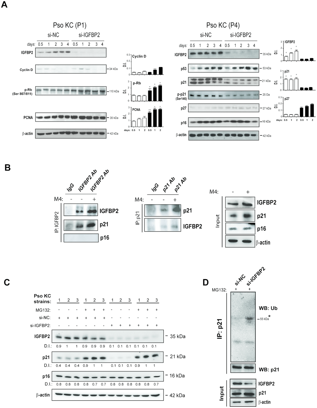 IGFBP2 interacts with p21 and protects it from ubiquitin-mediated proteasome degradation. (A) IGFBP2, p53, p21, p-p21, p27 and p16 protein expression was detected by WB analysis in pso KC cultured at passage 4 (P4, senescent cells) and silenced (si-IGFBP2) or not for IGFBP2 (si-NC) for different time points (right panels). Similarly, cyclin D, p-Rb and PCNA protein expression was detected in pso KC cultured at passage 1 (P1, pre-senescent cells) and silenced or not for IGFBP2 (left panels). In A and B, graphs show the mean ± SD of densitometric intensity (D.I.) of three independent experiments. *p ≤ 0.05, **p ≤ 0.01 as calculated by paired Student’s t test comparing si-IGFBP2 with si-NC. (B) Co-immunoprecipitation experiments were performed on protein lysates obtained from pso KC left untreated or treated by M4 for 6 hours and then immunoprecipitated with antibodies against IGFBP2 or goat IgG as negative control (IP: IGFBP2, left panel), and with p21 or mouse IgG (IP: p21, right panel). The immunoprecipitates were probed with anti-IGFBP2, -p21 or –p16 antibodies, as shown in left and right panels. WB analysis was also performed on cell lysates (Input) to detect IGFBP2 and p21 levels. Figures are representative of three independent experiments. (C) Protein extracts of three distinct pso KC strains, transfected with si-IGFBP2 or si-NC for 24 h and then treated or not with 20 μM of the proteasome inhibitor MG132 for 6 h, were subjected to WB for the detection of IGFBP2, p21 and p16 expression. WB panels are representative of three independent experiments and D.I. indicates values of densitometric intensity. (D) Endogenous p21 was immunoprecipitated by protein lysates obtained from pso KC cultures silenced or not for IGFBP2 for 24 h and treated with 20 μM of MG132 for 6 hours. WB analysis was performed for the detection of p21 ubiquitination by using anti-ubiquitin antibody. WB was also performed on cell lysates (Input) to detect IGFBP2 and p21 levels, as well as β-actin as loading control.