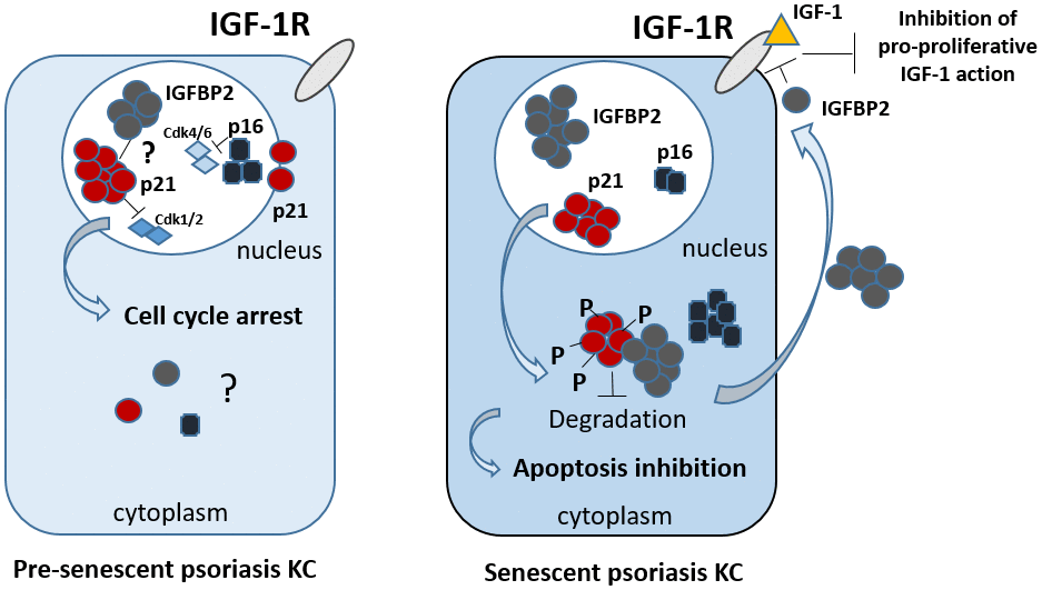 Proposed integrated model of the intracellular and extracellular functions of IGFBP2 in psoriasis keratinocytes. In epidermal keratinocytes of psoriasis patients characterized by a pre-senescent state, IGFBP2, p21 and p16 co-localize in the nuclear compartment. Here, p21 and p16 contribute to the cell cycle arrest in phase G1, by inhibiting Cdk1/2 and Cdk4/6, respectively. The nuclear role of IGFBP2 in pre-senescent KC remains to be investigated. In senescent psoriasis KC, IGFBP2, p16 and, of note, p21 accumulate in the cytoplasm. Here, p21 is hyper-phosphorylated and inhibits apoptotic processes. In the cytoplasm, IGFBP2 physically interacts with p21 and protects it from proteasomal degradation, thus sustaining its levels, and, indirectly, contributing to the apoptosis resistance typical of affected KC. In parallel, IGFBP2 released extracellularly blocks the pro-proliferative action of IGFs by binding to it and impeding its recruitment to IGF receptor.