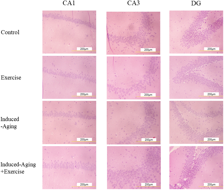 Representative micrographs of H&E staining in the CA1, CA3 and dentate gyrus (DG) regions of hippocampus for each group. The images of hippocampus architecture were magnified 400 times.
