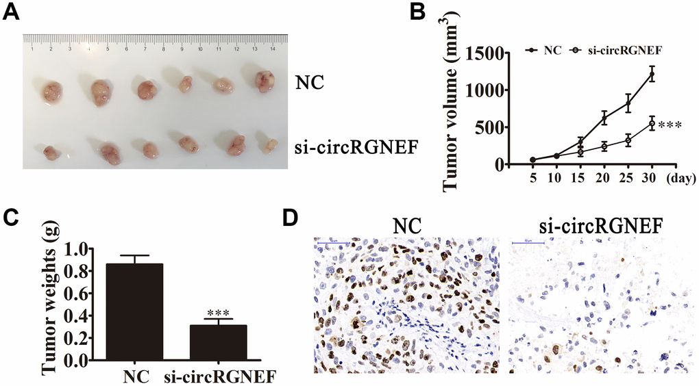 circRGNEF silencing suppressed tumor growth of xenografts in nude mice. (A, B) Photographs of tumors and curve of T24 tumor volume growth (B) of the nude mice. Data are presented as the mean ± SD. ***P C) Tumor weights. Data are presented as the mean ± SD. ***P D) Ki67 staining of tumor tissues.