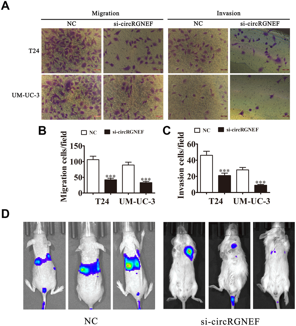 Knockdown of circRGNEF decreased the invasion ability of BC in vitro and in vivo. (A–C) Cell migration and invasion were assessed in T24 and UM-UC-3 cells using Transwell assays. Data are presented as the mean ± SD. ***P D) Live imaging shows the effects of circRGNEF on metastasis of T24 cells 30 days after intravenous tail injection.