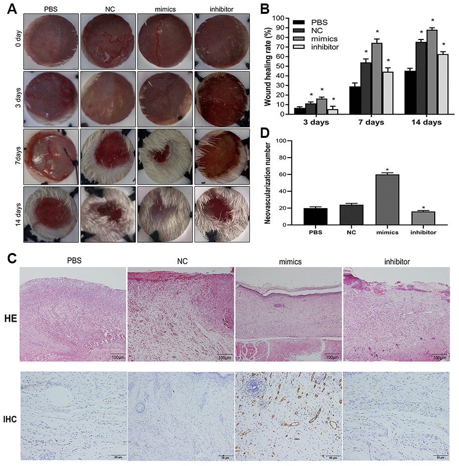 miR-1248 influences skin wound healing and immunohistochemistry in animal model. (A) Representative images of wound healing at time points after hADSC transplantation; (B) Histogram of statistical analysis of healing rate of wounds at different time points; (C) Histology of inflammatory cell infiltration from dermis to subcutaneous layers was detected by HE staining (Scale bar = 100 μm); and the content of CD31 in wound tissue was assessed by immunohistochemistry (Scale bar = 50 μm); (D) Quantification of CD31 in wound skin of different groups (* P