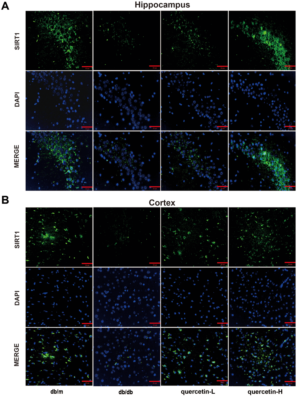 Quercetin activates SIRT1 in the brain of db/db mice. (A) Immunofluorescence of SIRT1 in hippocampus. (B) Immunofluorescence of sirt1 in cortex. Scale bar: 100 μm.