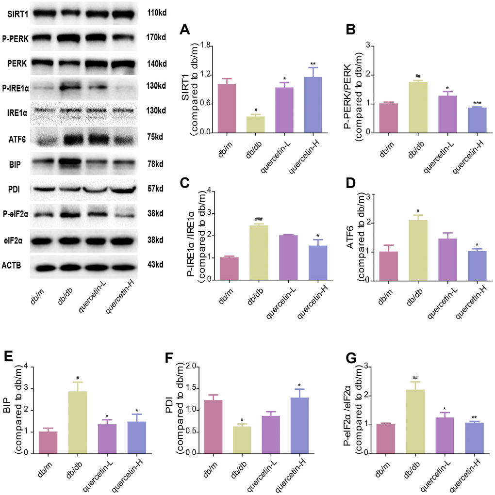 Quercetin activates SIRT1 and relieves ER stress in db/db mice. Western blot analysis: (A) SIRT1; (B) P-PERK/PERK; (C) P-IRE1α/IRE1α; (D) ATF6; (E) BIP; (F) PDI; (G) P-eIF2α/eIF2α. Quercetin-L: 35mg/kg/d; Quercetin-H: 70mg/kg/d. Data represent mean ± SEM (n = 10 per group). #p p p p p p 