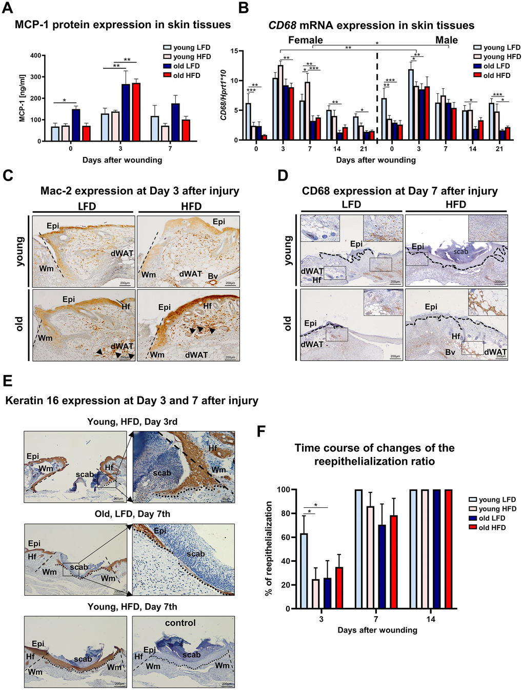 Inflammatory response and histological analysis of re-epithelialization during skin wound healing. (A) MCP-1 protein levels (n=6 skin samples per group); (B) CD68 mRNA expression (n=4-8 skin samples per group); (C) Mac-2 and (D) CD68 immunohistological localization on skin tissues at post-wounded day 3 (C) and day 7 (D). Immunohistochemical detection of keratin 16 (E) and morphometrical analysis (F) of the re-epithelization process in the skin of old, young, LFD or HFD mice (n = 3-5 mice per group). Epi - epidermis, dWAT - dermal white adipose tissue, Wm – wound margin, Hf – hair follicles; control (E) of immunohistochemical reaction where the primary antibody were omitted. Histological sections were counterstain with haematoxylin. Scale bar (C–E) 200μm, insets (C–E) 50μm. The bars indicate lsmean ±SE *p
