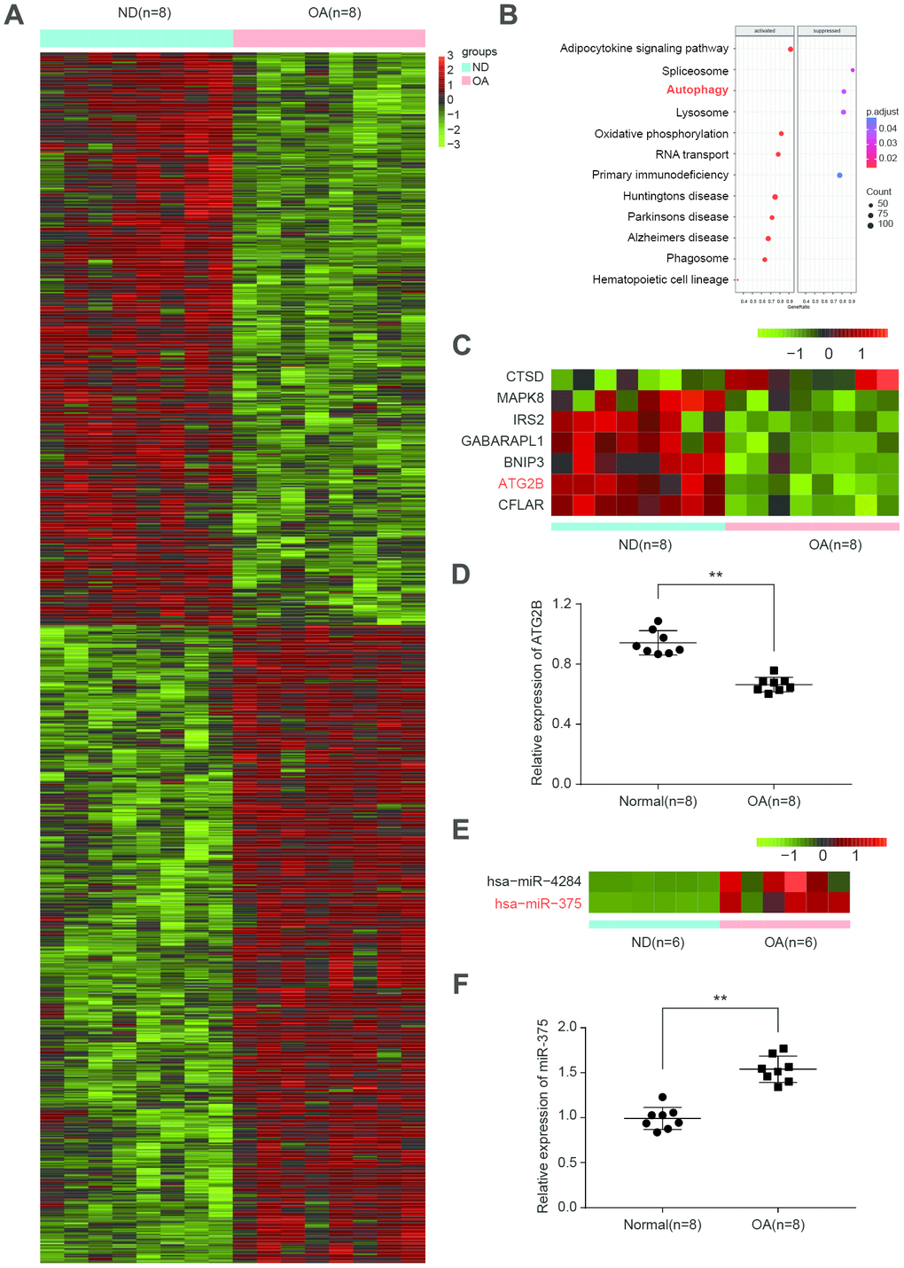 Differential expressed mRNAs and miRNAs related to autophagy in OA. (A) Heatmap of top differentially expressed mRNAs from 8 matched osteoarthritic and normal samples in osteoarthritis (OA) patients. (B) Significant function and pathways (PC) Heatmap depicting statistically significant (PD) Relative expression of ATG2B in osteoarthritic and normal samples was analyzed by qRT-PCR. (E) Heatmap depicting differentially expressed miRNAs related to autophagy from 6 matched osteoarthritic and normal samples. (F) Relative expression of miR-375 was analyzed by qRT-PCR.