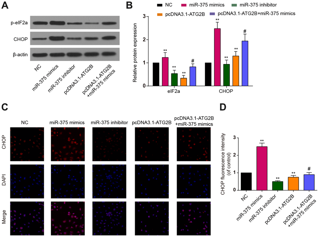 The effects of miR-375 and ATG2B on ERs. (A) Western blot of p-eIF2a and CHOP after infected with miR-375 mimics, miR-375 inhibitor, pcDNA3.1-ATG2B and pcDNA3.1-ATG2B plus miR-375 mimics in OA chondrocytes; (B) Qualitative analysis of p-eIF2a and CHOP, and the values were normalized to β-actin; (C, D) OA chondrocytes were double stained with CHOP (red) and DAPI (blue) and visualized by confocal microscopy after different treatment. ** PP