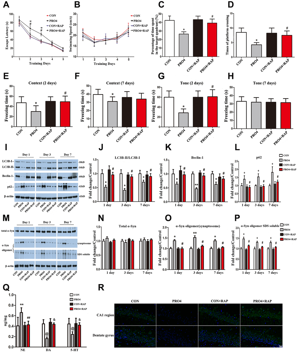 The effects of an autophagy agonist on propofol-induced changes in behavior, autophagy-related protein levels and α-synuclein levels in the hippocampus in aged rats. (A) Rapamycin (RAP) reversed the propofol anesthesia (4 h)-induced increase in escape latency. (B) Propofol anesthesia (4 h) and/or rapamycin did not alter the swimming speed. (C, D) Rapamycin reversed the propofol anesthesia (4 h)-induced decreases in the target quadrant dwelling time and the number of platform crossings. (E, F) Rapamycin ameliorated the propofol anesthesia (4 h)-induced decrease in the freezing time in the context test 2 and 7 days after anesthesia. (G, H) Rapamycin ameliorated the propofol anesthesia (4 h)-induced decrease in the freezing time in the tone test 2 and 7 days after anesthesia. (I) Representative immunoblots illustrating the effects of rapamycin on the propofol anesthesia (4 h)-induced changes in hippocampal autophagy-related protein levels. (J) Rapamycin reversed the propofol anesthesia (4 h)-induced decrease in LC3B expression in the hippocampus. (K) Rapamycin reversed the propofol anesthesia (4 h)-induced decrease in Beclin-1 expression in the hippocampus. (L) Rapamycin reversed the propofol anesthesia (4 h)-induced increase in p62 expression in the hippocampus. (M) Representative immunoblots illustrating the effects of rapamycin on the propofol anesthesia (4 h)-induced changes in α-synuclein (α-Syn) levels in the hippocampus. (N) Rapamycin did not alter total α-synuclein levels. (O, P) Rapamycin reversed the propofol anesthesia (4 h)-induced increases in α-synuclein oligomer levels in synaptosomes and SDS-solubilized fractions in the hippocampus. (Q) Rapamycin reversed the propofol anesthesia (4 h)-induced changes in neurotransmitter levels in the hippocampus. (R) Representative confocal staining of LC3B expression in the CA1 and DG regions of the hippocampus in the four groups of rats 7 days after propofol anesthesia. Values are expressed as the mean ± SEM (n = 10 per group for behavioral tests, n = 8 per group for neurotransmitter detection, n = 6 per group for Western blot analysis, n = 4 per group for confocal analysis of LC3B staining). *p p @p p p &p R).