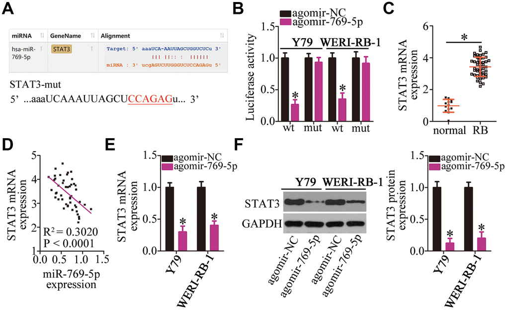 Validation of STAT3 mRNA as a direct target of miR-769-5p in RB cells. (A) The wild-type miR-769-5p–binding site in the 3′-UTR of STAT3 mRNA was predicted by bioinformatic analysis. The mutant binding site is also shown. (B) The luciferase reporter plasmid harboring either the wild-type or mutant miR-769-5p–binding site was cotransfected with either agomir-769-5p or agomir-NC into Y79 and WERI-RB-1 cells. The Dual-Luciferase Reporter Assay System was used to detect the Firefly luciferase activity by normalizing it to the activity of Renilla luciferase. *P C) RT-qPCR was carried out to quantitate STAT3 mRNA in the 47 RB tissue samples and 13 normal retinal tissue samples. *P D) Spearman’s correlation analysis was performed to study the correlation between the expression of miR-769-5p and STAT3 mRNA among the 47 RB tissue samples; R2 = 0.3020, P E, F) Y79 and WERI-RB-1 cells were transfected with either agomir-769-5p or agomir-NC. The mRNA and protein levels of STAT3 were measured by RT-qPCR and western blotting, respectively. *P 