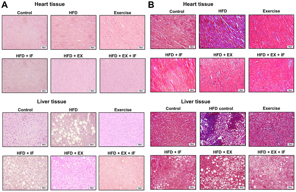 IF peptide administration in combination with exercise training on HFD induced heart and liver histology in aging model. Hematoxylin and eosin (A) and Masson’s trichrome (B) staining on heart and liver tissues obtained after IF administration and 15 weeks of exercise training show difference in liver and heart histology among different groups (n=6) of SAMP8. C: Control; HF: High-fat diet; EX: Exercise; HF+IF: High-fat diet+IF; HF+EX: High-fat diet+ Exercise; HF+EX+IF: High-fat diet+ Exercise+ IF. Scale bars, 50 μm. (Magnification, 200x).