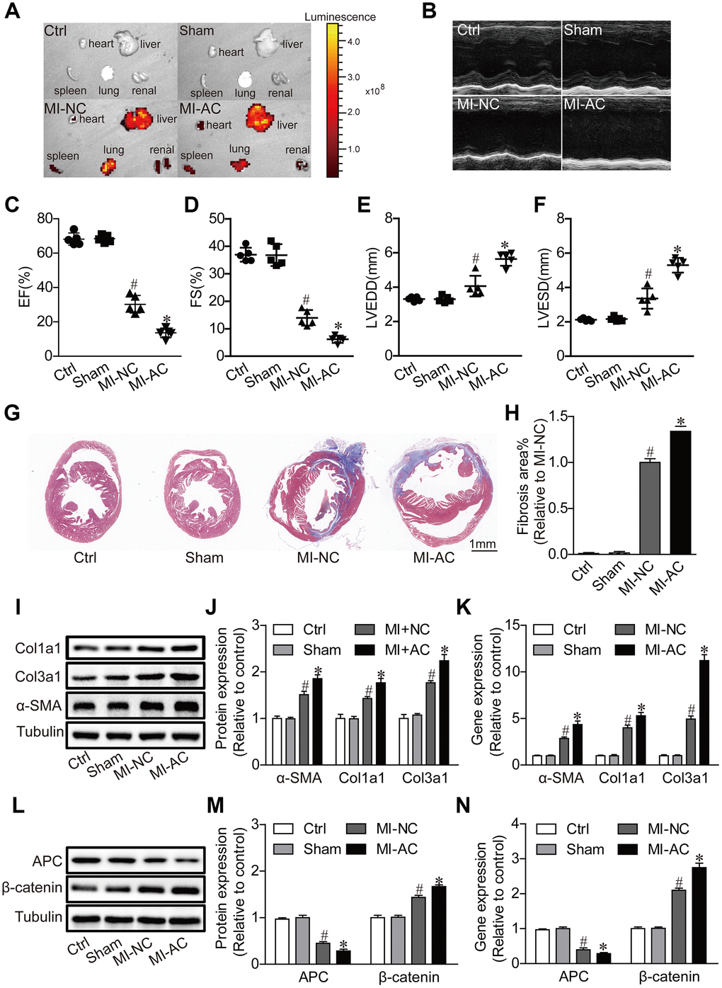 Activated CD4+ T cells-derived exosomes deteriorate cardiac function post-MI in mouse. (A) Ex vivo fluorescence imaging of major organs from mice. MI-NC: mice underwent myocardial infarction and injected with DiO-labeled naive CD4+- exosomes by by tail vein. MI-AC: mice underwent myocardial infarction and injected with DiO-labeled activated CD4+- exosomes by by tail vein. (B) Representative echocardiography at the fourth week post-MI. n = 5 per group. (C–F) Statistic summary from (B). EF: ejection fraction; FS: fractional shortening; LVESD: left ventricular end-systolic dimension; LVEDD: left ventricular end-diastolic dimension (n = 5). #P G, H) Masson's trichrome staining of the cross section of the heart and quantification of the total fibrotic area using Image J software. The images shown are representative of three independent experiments. n = 5 per group. Scale bar = 1mm. #P I) Expression levels of α-SMA, Col1a1 and Col3a1 were detected by western blot analysis. The blots shown are representative of three independent experiments. (J) Quantitative analysis of proteins expression of -SMA, Col1a1 and Col3a1 using Image J software. #P K) qPCR analysis of α-SMA, Col1a1 and Col3a1 levels in the myocardium. n=3 per group. #P L) Western blotting examination of APC and β-catenin protein expression. The blots shown are representative of three independent experiments. (M) Quantitative analysis of proteins expression of APC and β-catenin using Image J software. #P N) qPCR analysis of APC and β-catenin levels in the myocardium. n=3 per group. #P 