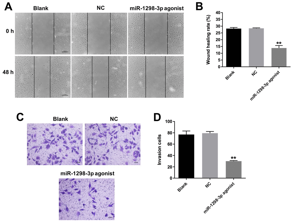 Overexpression of miR-1298-3p inhibits migration and invasion of glioma cells. (A, B) Migration of U87MG cells transfected with miR-1298-3p agonist for 48 h, analyzed by wound healing assay. (C, D) Invasion ability of U87MG cells transfected with miR-1298-3p agonist for 24 h, analyzed by transwell invasion assay; **P 